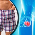 Male fertility diagnosis2