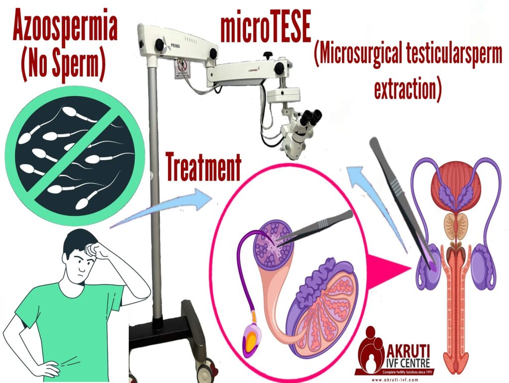 Azoospermia sperm recovery compressed