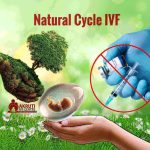 Natural Cycle IVF