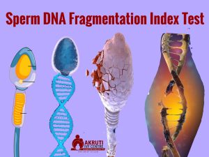 Sperm DNA Fragmentation Index Test 1